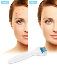 Carica l&#39;immagine nel visualizzatore di Gallery, Winpok Dermaroller, 6 in 1 Derma Roller Kit, 12/300/ 720/1200 Aghi, bianco - Ilgrandebazar