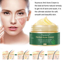 Carica l&#39;immagine nel visualizzatore di Gallery, Acne Crema, Crema Anti Acne, Cicatrici Viso... - Ilgrandebazar