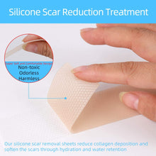 Carica l&#39;immagine nel visualizzatore di Gallery, Fogli cicatriziali in silicone, ustione da acne, cesareo, chirurgia, cheloide, trattamento di cicatrici vecchie e nuove, strisce di tessuto adesivo morbido, 3,5 x7,5 cm, 4 fogli riutilizzabili