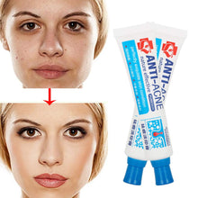 Carica l&#39;immagine nel visualizzatore di Gallery, Acne Crema, Crema Anti Acne, Cicatrici Viso 30g - Ilgrandebazar