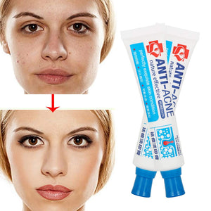 Acne Crema, Crema Anti Acne, Cicatrici Viso 30g - Ilgrandebazar
