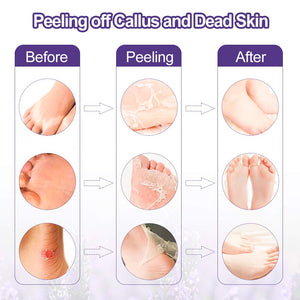 Maschera Piedi, LARALA 2 Paia Calli Piedi Peeling Esfoliante viola - Ilgrandebazar