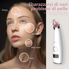 Carica l&#39;immagine nel visualizzatore di Gallery, Mosen Aspiratore Punti Neri Rimozione di Comedone Pulitore dei Pori Professionale Estrattore Vacuum Punti Neri Ricaricabile USB, Display a LED e 5 Testine per Rimozione di Comedoni, Brufoli, Grasso