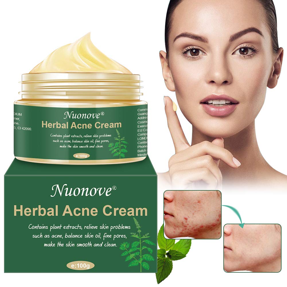 Acne Crema, Crema Anti Acne, Cicatrici Viso... - Ilgrandebazar