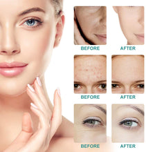 Carica l'immagine nel visualizzatore di Gallery, Hemp Cream,Hemp Balm, Crema viso alla canapa,Antinfiammatorio, Anti-Acne, Anti-Ossidante, Antirughe, Anti-Aging, 40g
