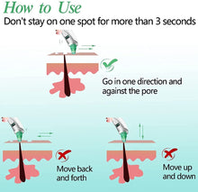 Carica l'immagine nel visualizzatore di Gallery, Aspiratore Punti Neri,Aspiratore Punti Neri Vacuum,Rimozione di Comedone,Blackhead Remover Vacuum,Macchina USB ricaricabile per rimuovere i punti neri per la pulizia del naso del viso green