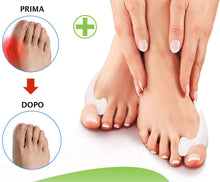 Carica l&#39;immagine nel visualizzatore di Gallery, Take Inspire Tutore Alluce Valgo 6 pezzi Correttore Separatore in Morbido Silicone Protezione Dolore Borsite Distanziatore Raddrizza Dita a Martello Piedi Protettore Supporto Uomo Donna