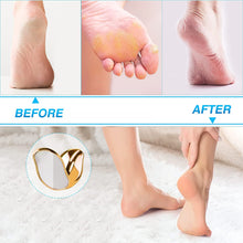Carica l&#39;immagine nel visualizzatore di Gallery, Raspa Piedi Professionale in Vetro Nano Togli Calli Piedi, Bagnata e Asciutta 2 in 1, Veloce, Sicura ed Efficace per la Cura dei Piedi Domestica, Oro