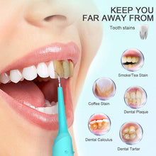 Carica l&#39;immagine nel visualizzatore di Gallery, Jkevow Pulizia Denti Dentale Tartaro Rimozione Pulisci Acciaio Pulizia Dentale Sbiancamento dei Denti kit 2 Teste (Blu)