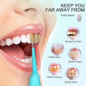 Jkevow Pulizia Denti Dentale Tartaro Rimozione Pulisci Acciaio Pulizia Dentale Sbiancamento dei Denti kit 2 Teste (Blu)