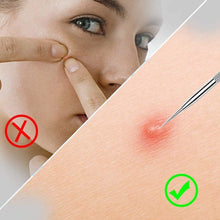Carica l'immagine nel visualizzatore di Gallery, Blackhead Set,VIMILOLO Pinza Rimozione Punti Neri Naso Leva Acciaio Inox Comedoni Professionale per Uomo Donne Estrattore Strumento per Pulizia Acne dal Viso Strumenti per Punti Neri