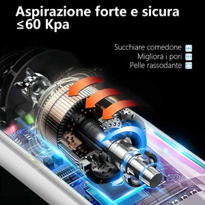 Mosen Aspiratore Punti Neri Rimozione di Comedone Pulitore dei Pori Professionale Estrattore Vacuum Punti Neri Ricaricabile USB, Display a LED e 5 Testine per Rimozione di Comedoni, Brufoli, Grasso