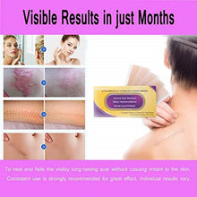 Carica l&#39;immagine nel visualizzatore di Gallery, Fogli cicatriziali in silicone, ustione da acne, cesareo, chirurgia, cheloide, trattamento di cicatrici vecchie e nuove, strisce di tessuto adesivo morbido, 3,5 x7,5 cm, 4 fogli riutilizzabili