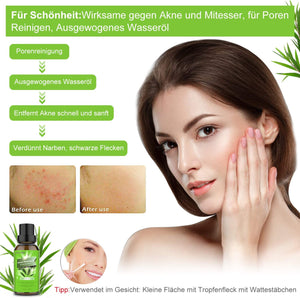 Tea Tree Oil Puro 100% Olio Essenziale di Albero del Tè Naturale - Olio Essenziale Tea Tree Olio di Acne - Anti Acne e Brufoli Trattamento per Pelli Impure, per Aromaterapia Diffusore - 30ml