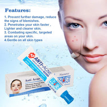 Carica l&#39;immagine nel visualizzatore di Gallery, Acne Crema, Crema Anti Acne, Cicatrici Viso 30g - Ilgrandebazar
