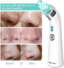 Carica l&#39;immagine nel visualizzatore di Gallery, Aspiratore Punti Neri, Pulitore dei Pori – Estrattore Elettrico di Punti neri e Acne, modello USB con Upgrade 2020 con 5 velocità di aspirazione regolabili e 4 testine di ricambio