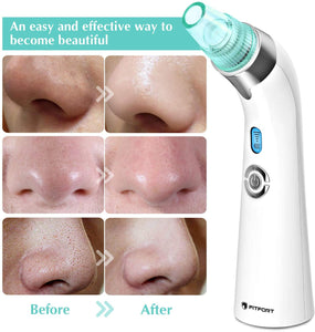 Aspiratore Punti Neri, Pulitore dei Pori – Estrattore Elettrico di Punti neri e Acne, modello USB con Upgrade 2020 con 5 velocità di aspirazione regolabili e 4 testine di ricambio
