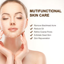 Carica l'immagine nel visualizzatore di Gallery, Aspiratore Punti Neri, Rimozione del Comedone USB Ricaricabile blackhead A11 - Ilgrandebazar