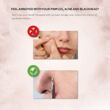 Carica l&#39;immagine nel visualizzatore di Gallery, Pinza Rimozione Punti Neri Naso Leva Comedoni IZUKU [GARANZIE A VITA] Blackhead Remover Kit Acciaio da 6 Strumenti Professionali con Due Estremità,togli i Punti Bianchi e le Macchie Acne dal Viso