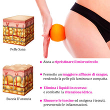 Carica l&#39;immagine nel visualizzatore di Gallery, VicoTM Cup | Coppetta Anticellulite Massaggiatore Cellulite Rassodante...