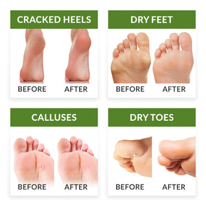 FitFoot maschera piedi esfoliante baby foot peeling calzini Verde - Ilgrandebazar