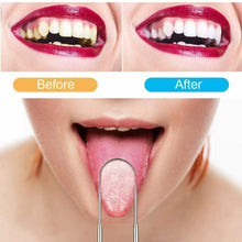 Carica l&#39;immagine nel visualizzatore di Gallery, Kit completo per rimozione tartaro e pulizia dentale, Set per denti e igiene