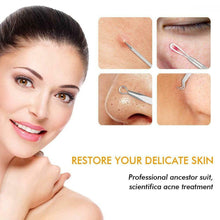 Carica l'immagine nel visualizzatore di Gallery, Rimozione Punti Neri Naso Leva Comedoni 7PCS Blackhead Remover Kit per Punti...