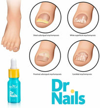 Carica l'immagine nel visualizzatore di Gallery, TRATTAMENTO ANTIFUNGINO PER LE UNGHIE DR.NAILS - Con olio di argan, olio...