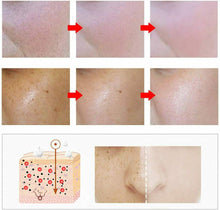 Carica l&#39;immagine nel visualizzatore di Gallery, Crema viso Anti-Macchie, Crema Depigmentante e Schiarente, 30ml