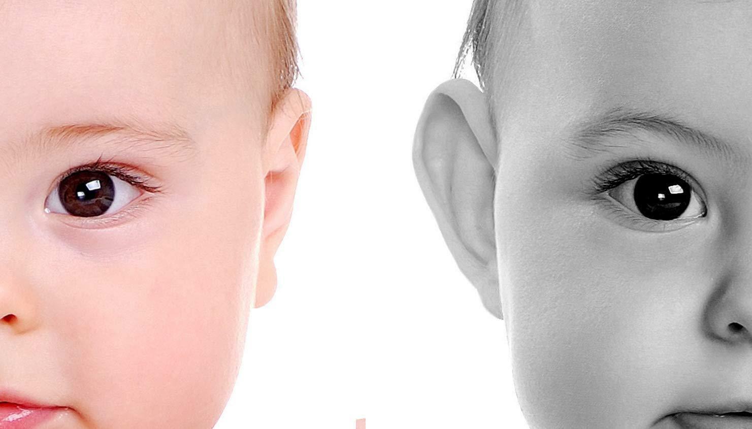 Correttore estetico Per orecchie a sventola neonato, Otostick, 8