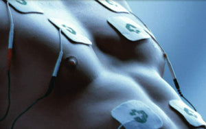 Tesmed MAX 830 con 20 elettrodi elettrostimolatore muscolare professionale :...