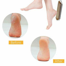 Carica l'immagine nel visualizzatore di Gallery, File del piede Rimozione callo per pedicure - Lime la cura dei...