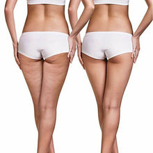 Carica l'immagine nel visualizzatore di Gallery, Massaggiatore anticellulite: spremi la cellulite grazie ai rulli brevettati!