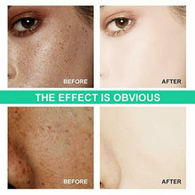 Carica l'immagine nel visualizzatore di Gallery, Crema Sbiancante, Sbiancante,Whitening Cream,Crema Macchie Macchie...